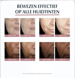 Eucerin Anti-Pigment Spotcorrector - Concealer - 5 Ml -Cosmetic Verkoop 1157x1200 1