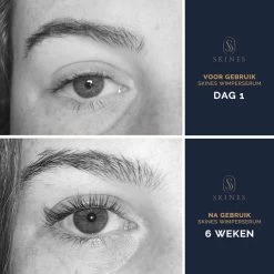 Skines® Wimperserum Premium – Eyelash Serum - Wenkbrauw Serum - Wimper Groei - 3ML -Cosmetic Verkoop 1200x1200 1067