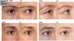 L'Oréal Paris Clinically Proven Wimperserum - 2 Ml -Cosmetic Verkoop 1200x670 1