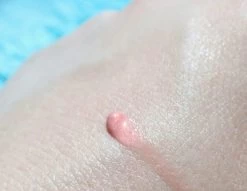 Biodermal Sun Lipbalm SPF25 - Tube 12 Ml - Natural Pink - Lippenbalsem -Cosmetic Verkoop 1200x927 3